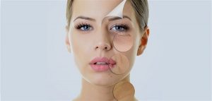 2 laser skin rejuvenationجوانسازی پوست با استفاده از لیزر 1
