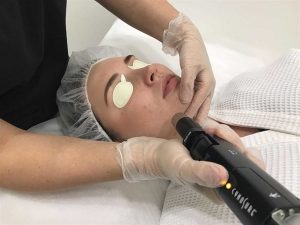 2 laser skin rejuvenationجوانسازی پوست با استفاده از لیزر 3