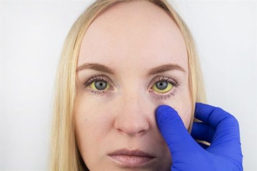 Symptoms of vitamin B12 deficiency that appear on your face 3