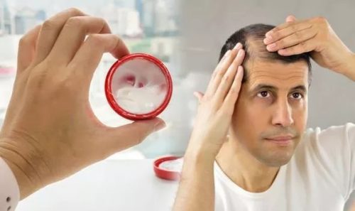 درمان خانگی ساده و فوری برای جلوگیری از ریزش موها 2