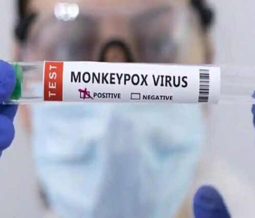 شناسایی اولین مورد ابتلا به آبله میمونی در ایران/راه‌های انتقال و علائم این بیماری