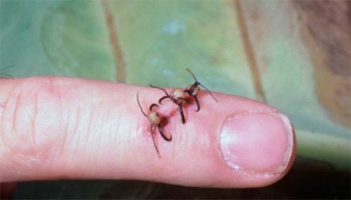 از مورچه های سوار یا سافاری می توان به عنوان بخیه برای بستن زخم ها و برش های روی پوست استفاده کرد