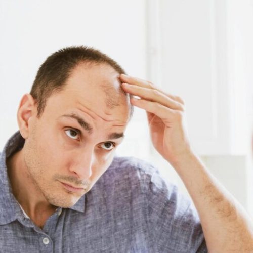 ۹ راهکار ساده برای جلوگیری از ریزش مو که باید بدانید