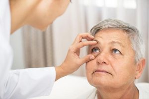 What is cataract 3